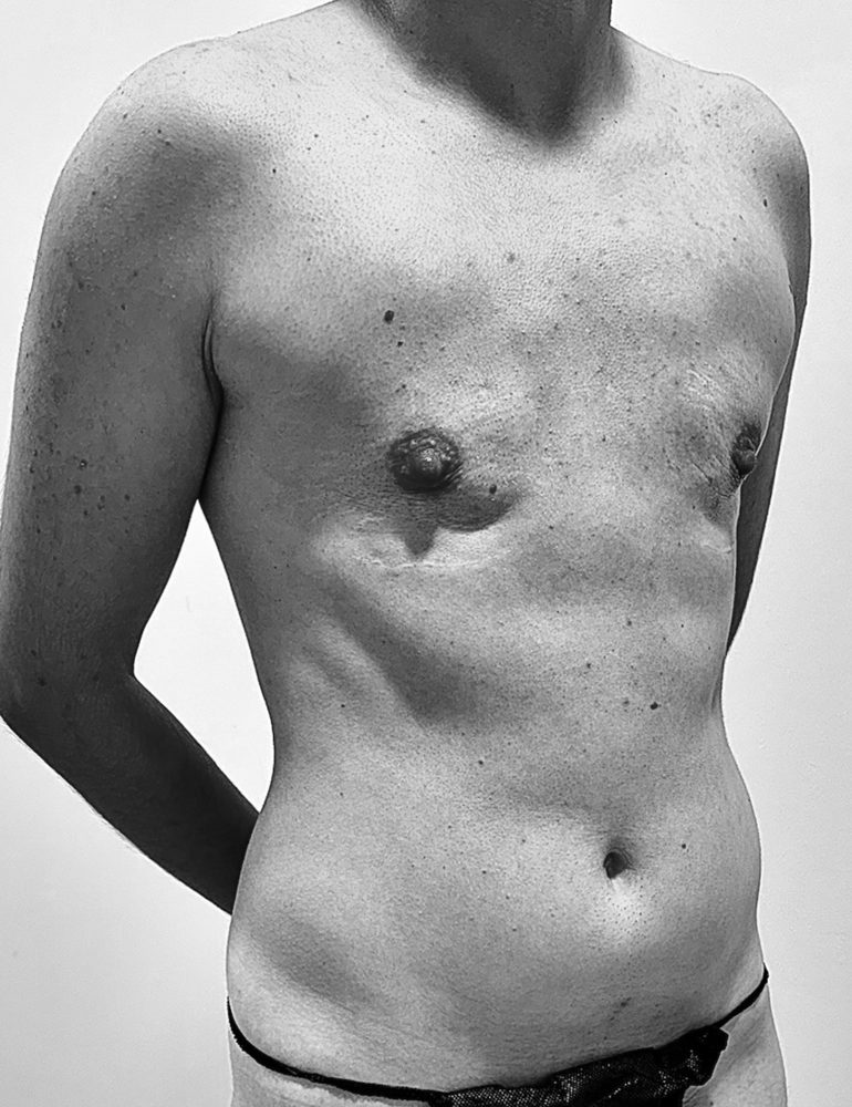 masculinizacion a traves de liposculpt 4d antes