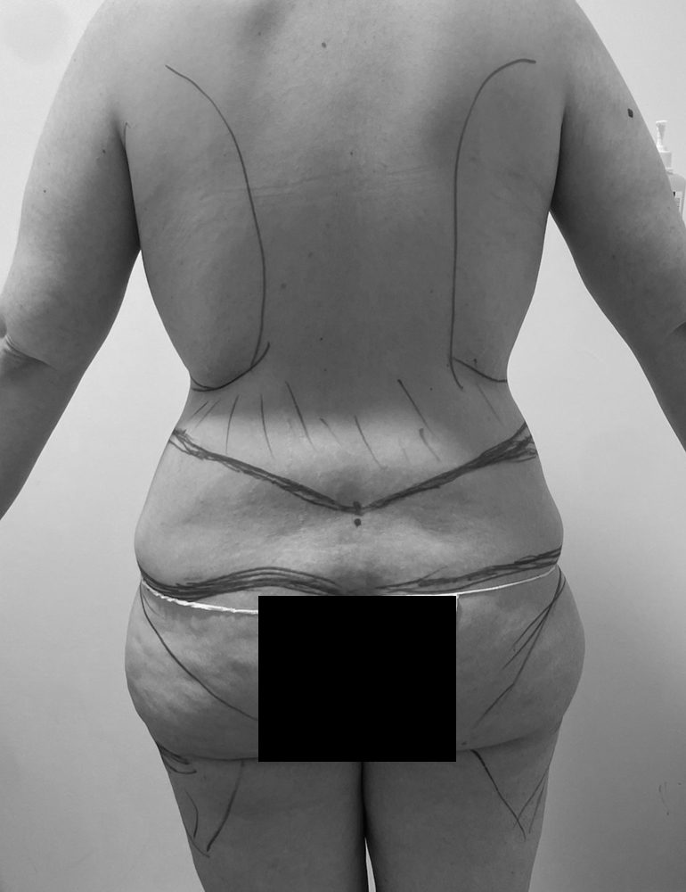 web por separado 202