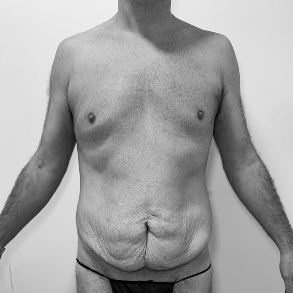 post batriatrica antes1