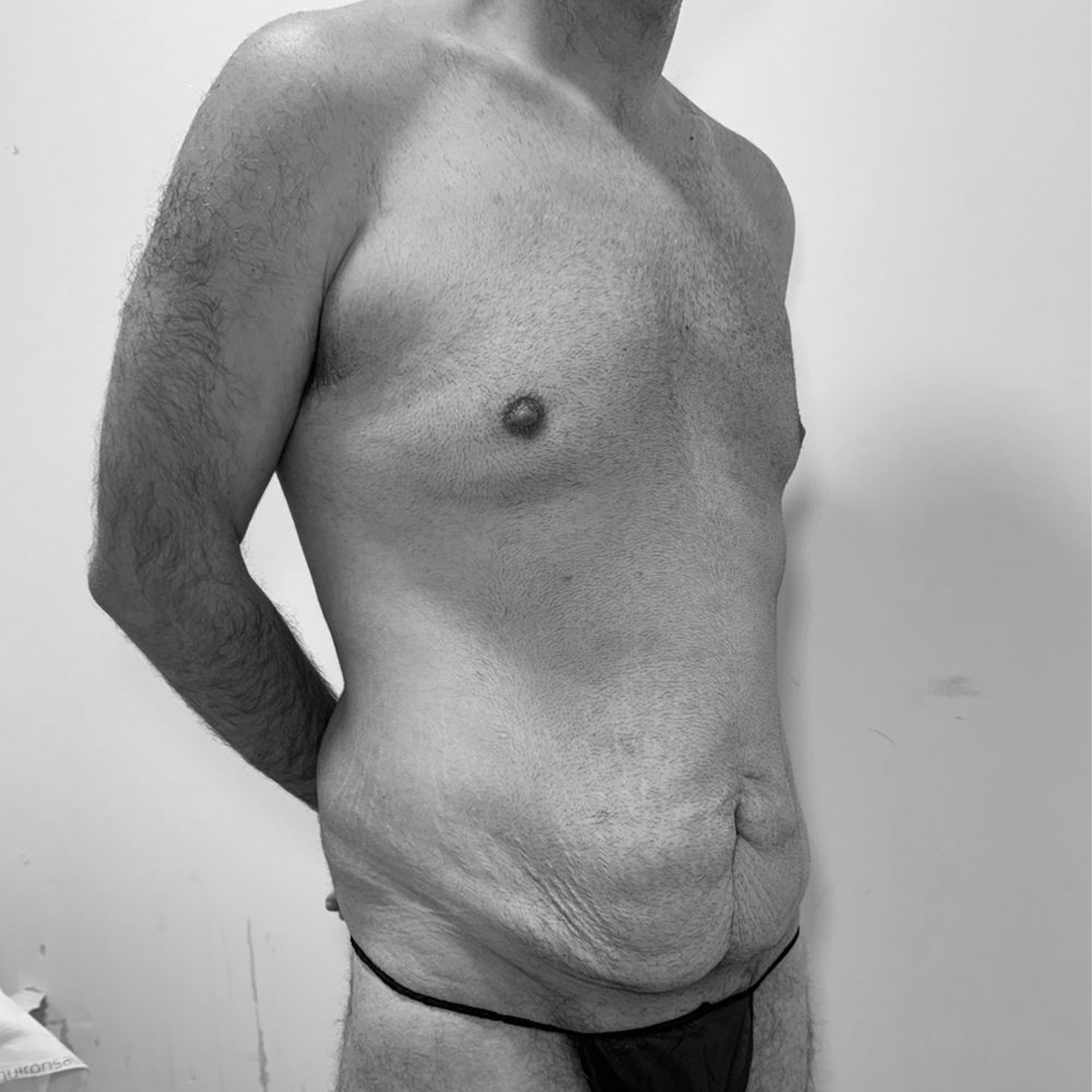 post batriatrica antes2