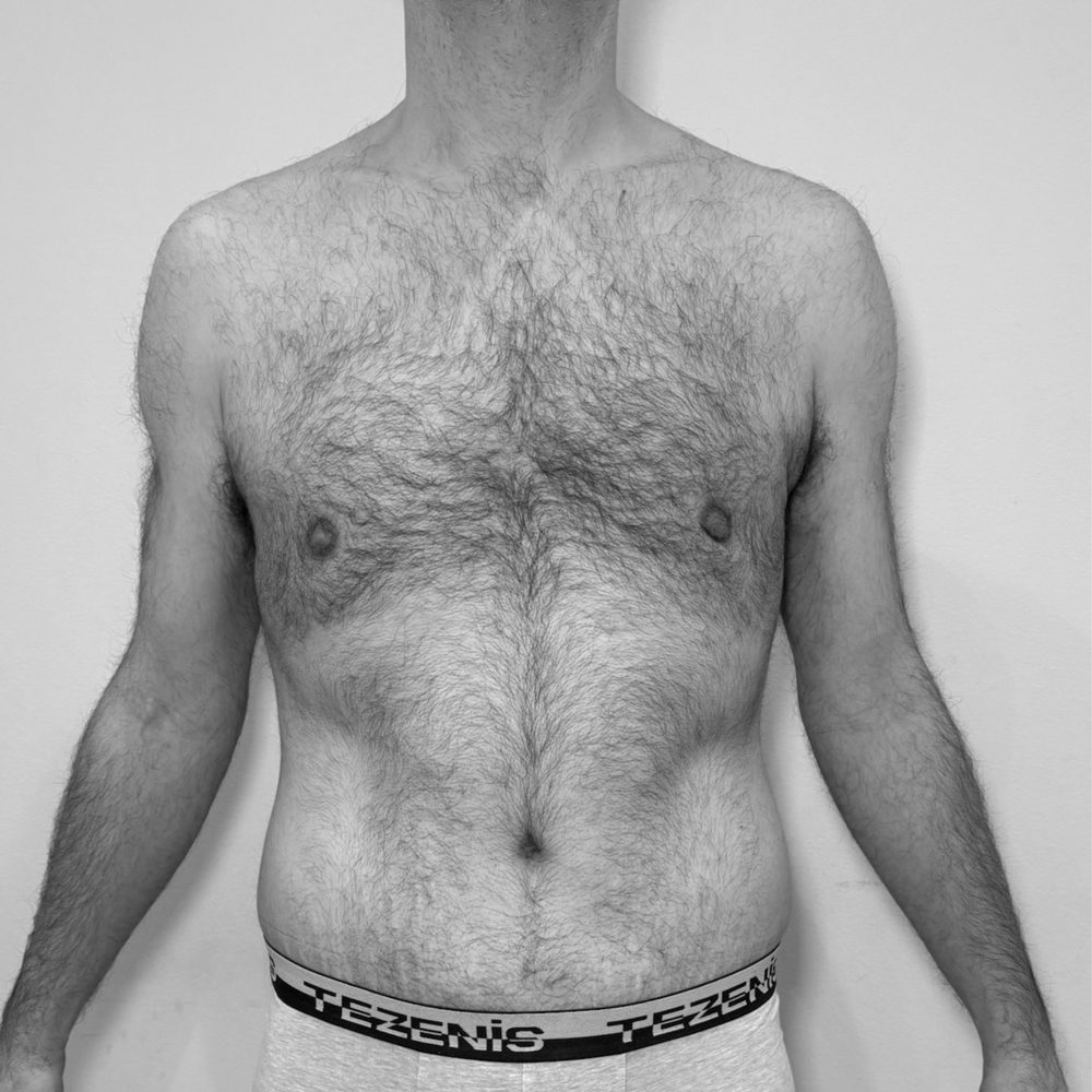 post batriatrica despues1