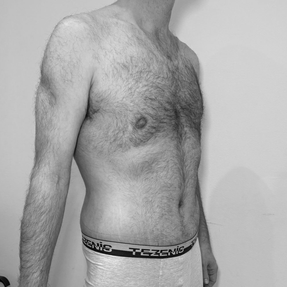 post batriatrica despues2