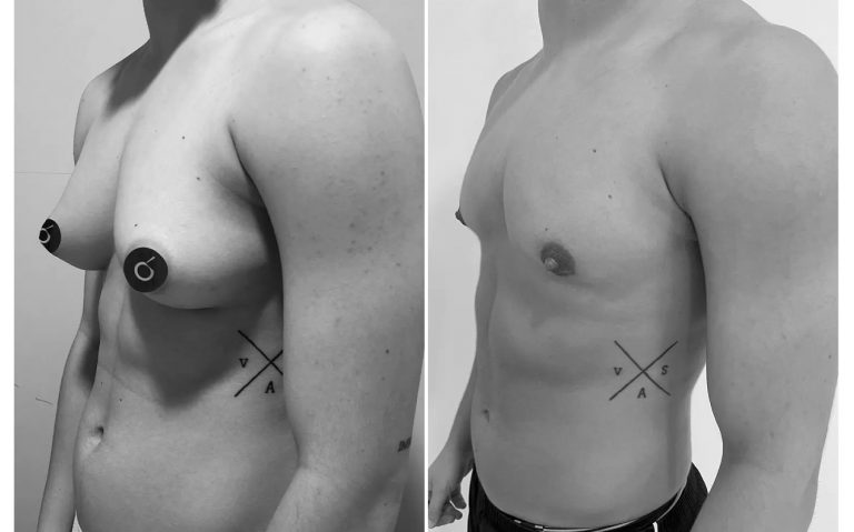 masculinización corporal para personas trans