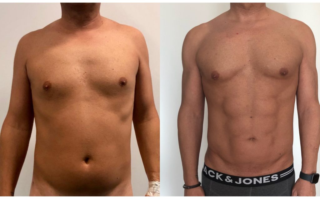 marcación abdominal para hombres