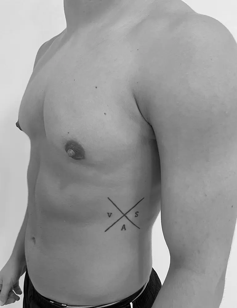 Mastectomía subcutanea ultrasónica