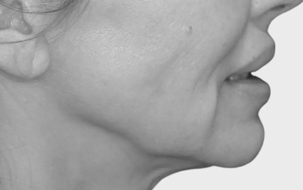 lifting b2 lifting b2