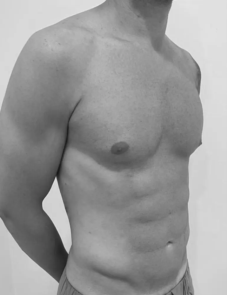 liposculpt4d+ hombre