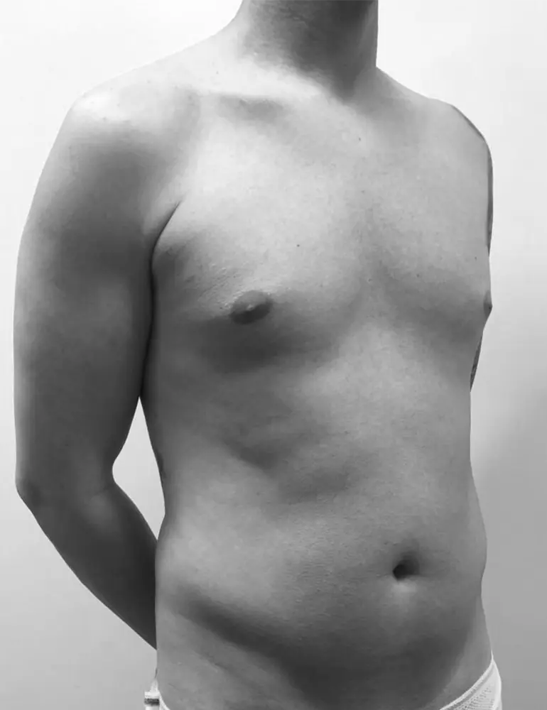 liposculpt4d+ hombre