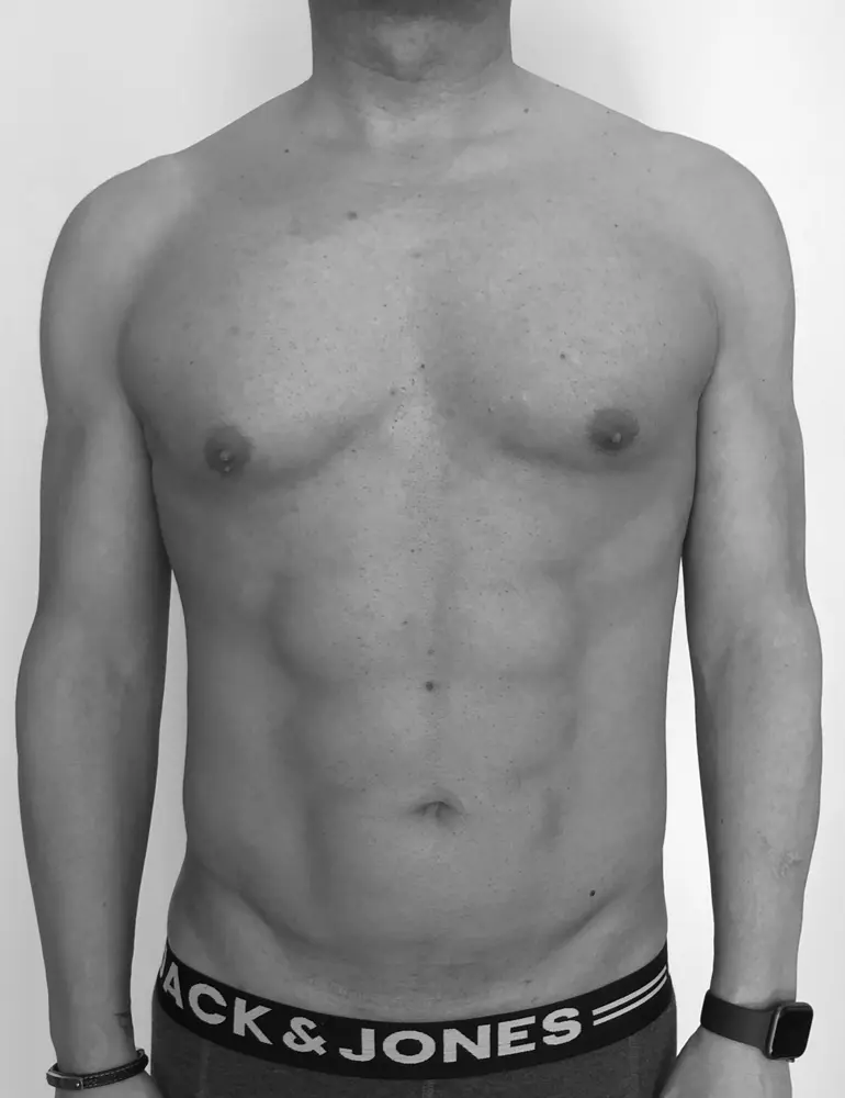 liposculpt4d+ hombre