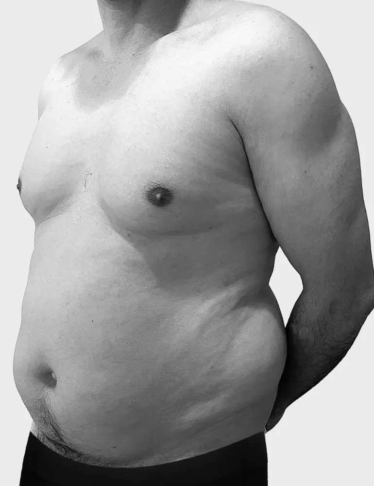 liposculpt4d+ hombre