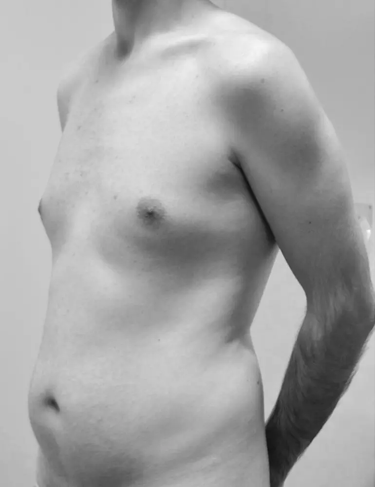 liposculpt4d+ hombre